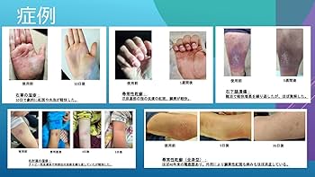 Amazon | アイラグ BNクリームEX | AIRAG | 乳液・クリーム 通販